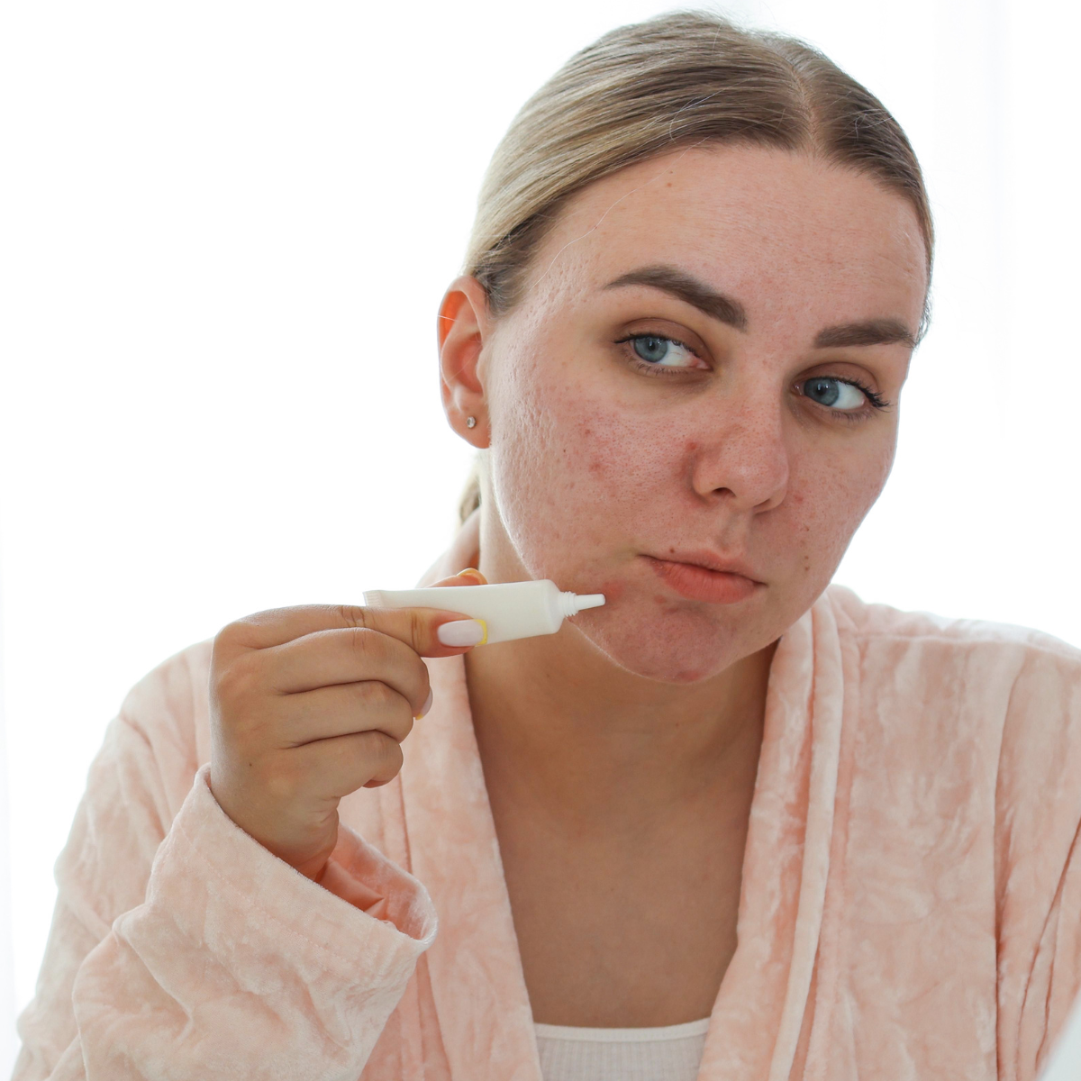 The Real Acne Solution Class | February 9, 2026 | 10:00 AM – 3:00 PM